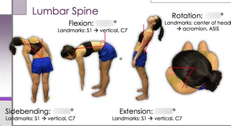 ROM - Lumbar spine Diagram | Quizlet