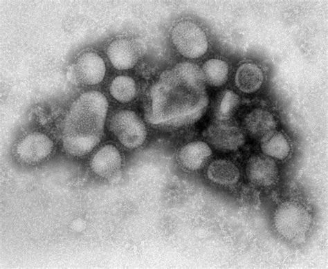 CDC H1N1 Flu | Images of the H1N1 Influenza Virus