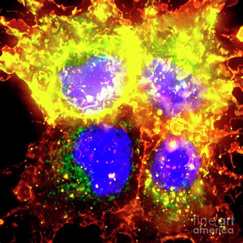 Trophoblasts Photograph by R. Bick, B. Poindexter, Ut Medical School ...