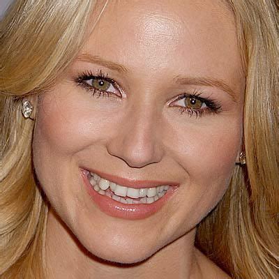 Celebrity jewel teeth before and after - http://www.surgeryafter.com/celebrity-jewel-teeth ...