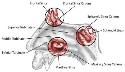 Ostium Maxillary Sinus