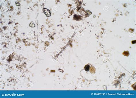 Marine Aquatic Plankton Under the Microscope View. Stock Image - Image ...