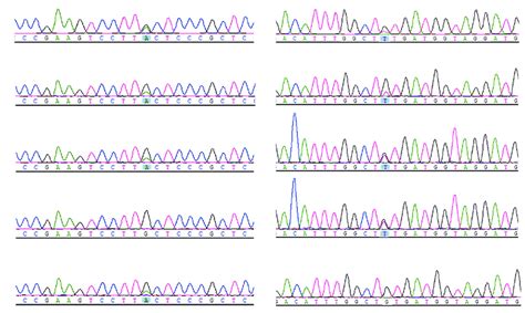 Sanger sequencing showing the mutation in the ADAMTS13 gene. | Download Scientific Diagram