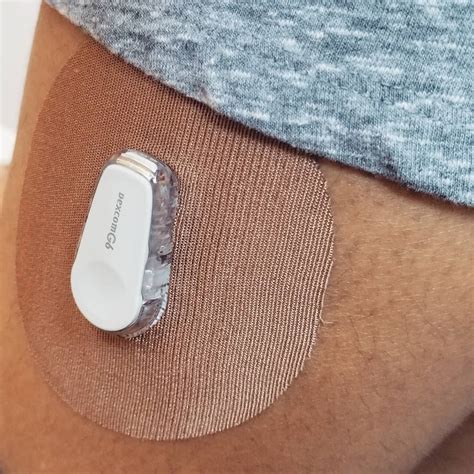 Dexcom G6 Adhesive Patches | Skin Grip