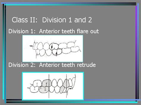 Occlusion Chapter 20 Definition Occlusion is defined as