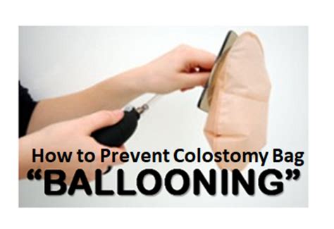 How to Prevent Colostomy Bag Ballooning | HealDove