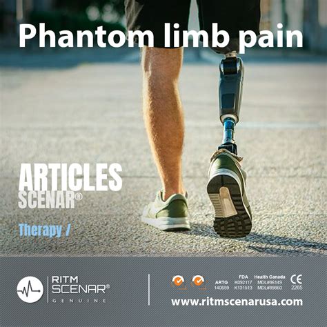 Phantom limb pain › RITMSCENAR