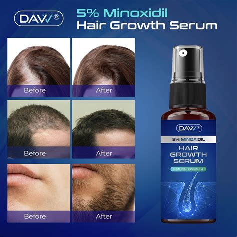 5% Minoxidil Hair Growth Serum with Biotin - 60mL | Men's Hair Regrowth Treatment for Stronger ...