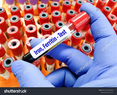 Blood Sample Iron Ferritin Level Test Stock Photo 2143544649 | Shutterstock