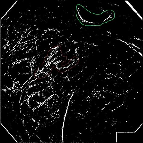 Removing parallel edges from binary image - Signal Processing Stack Exchange