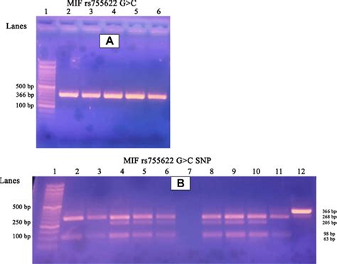 (A) Represents gel electrophoresis of the PCR products. Numbers refer... | Download Scientific ...