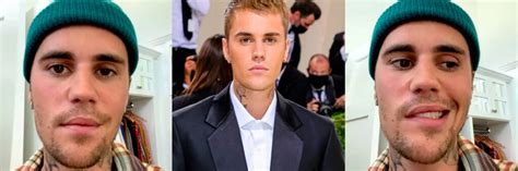 What you need to know about Justin Bieber’s facial paralysis - VIDA ...