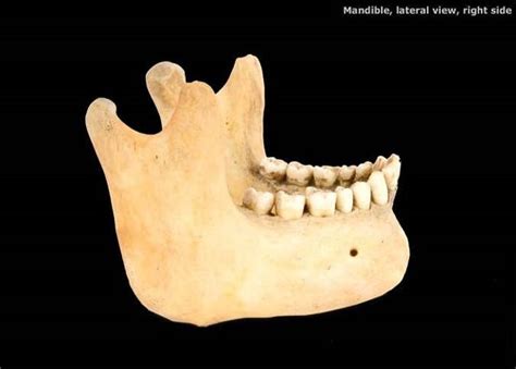 MANDIBLE Diagram | Quizlet