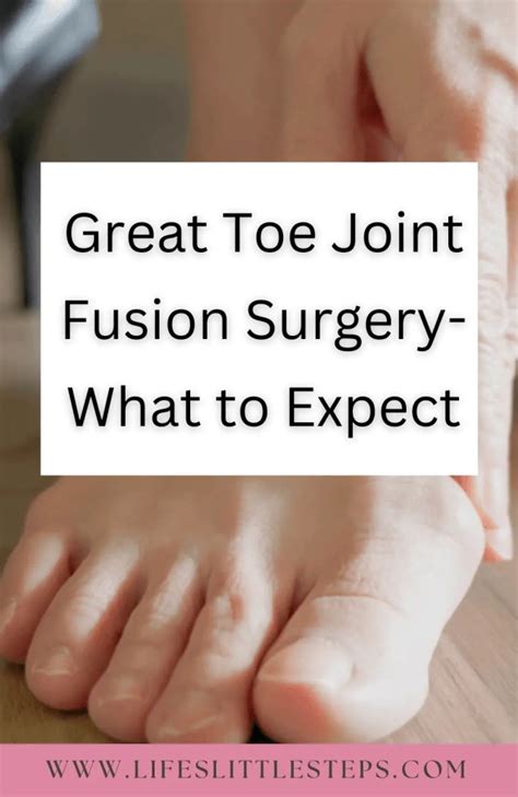 Big Toe Joint Fusion Surgery: Treatment for Arthritis Pain