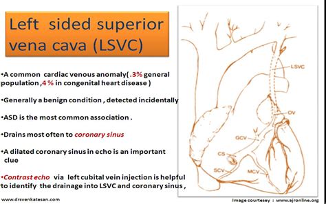 cardiology -congenital heart disease | Dr.S.Venkatesan MD | Page 3