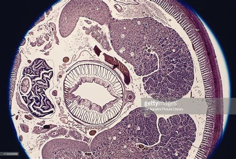 Cross section of the front of an earthworm in which they differ in... | Earthworms, Stock ...