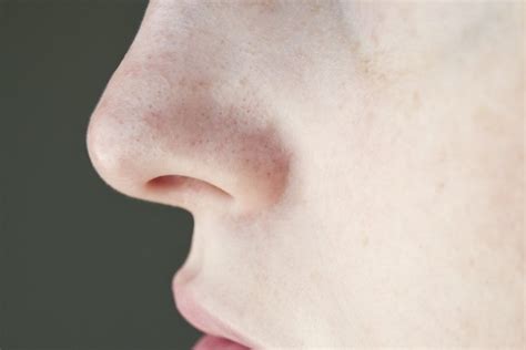 How to Remove Clogged Pores on the Nose | Flipboard