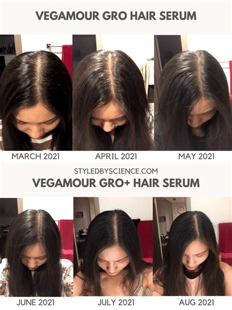 Vegamour Before and After: Does it help with hair growth? - Styled by Science