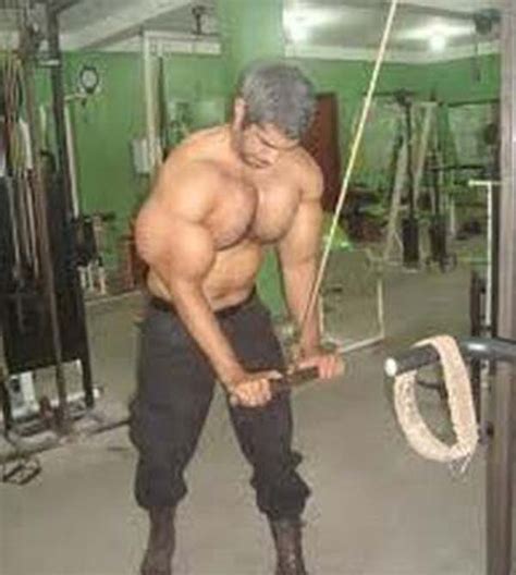 Synthol Gone Wrong (57 photos) | KLYKER.COM