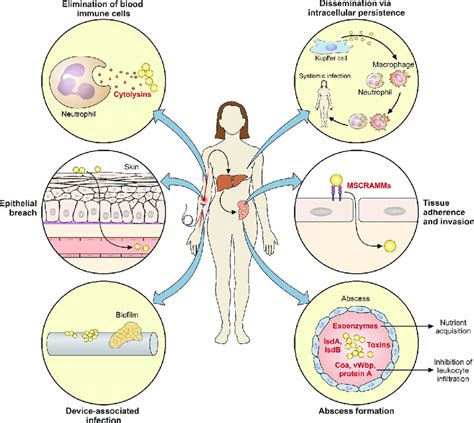 Staphylococcus Aureus Infection Causes And Prevention | SexiezPicz Web Porn