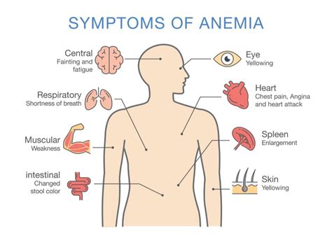 The Causes of Anemia | Things Health