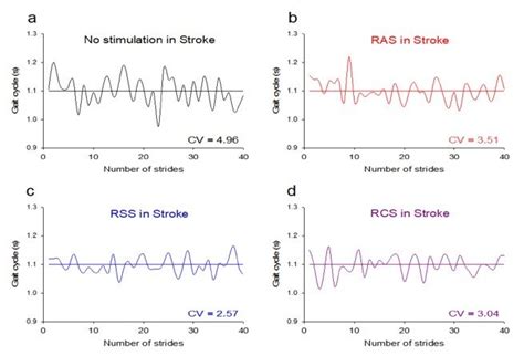 Examples of gait cycle from a patient with stroke in all walking ...