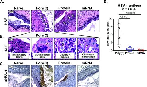 Histopathology and immunohistochemistry four days after HSV-1... | Download Scientific Diagram