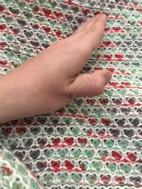 How To Dislocate Your Thumb (14 pics)