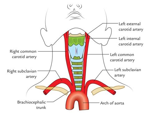 Related image | Carotid artery, Arteries, Internal carotid artery