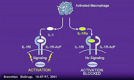 Interleukin-1 Inhibition at Treatment for Rheumatoid Arthritis on Johns Hopkins Arthritis