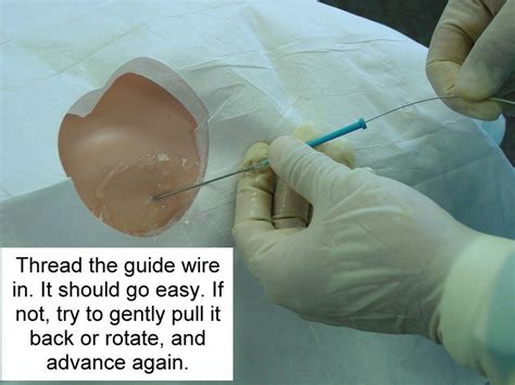 Clinical Notes: Central Line Placement: A Step-by-Step Procedure Guide with Photos