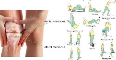 Beneficial And Repairing Knee Strengthening Exercises For A Meniscus ...