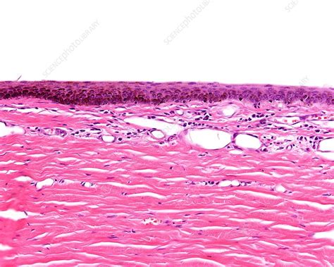 Conjunctiva layer of eye, light micrograph - Stock Image - C047/7764 ...