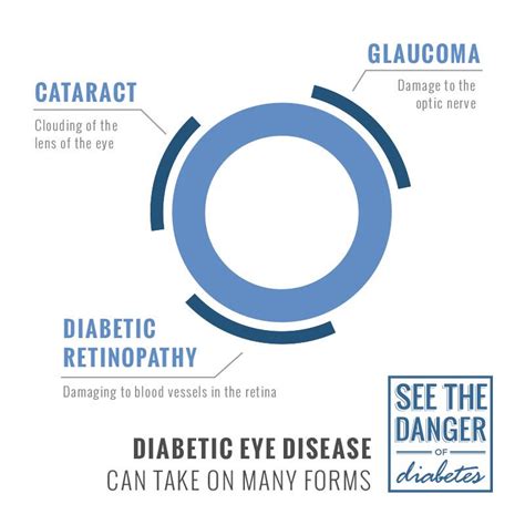 Glaucoma And Diabetes - DiabetesWalls