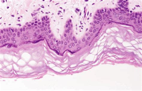 A microscope image of the epidermis. The epidermis is composed of four... | Download Scientific ...