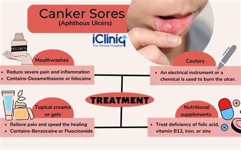 Canker Sore Stages