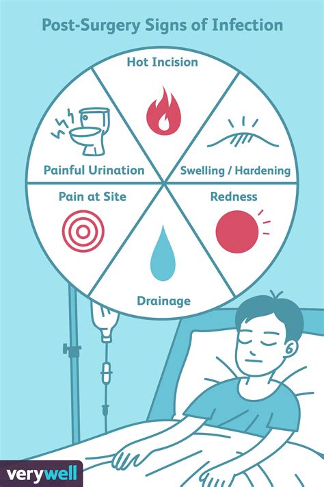 Signs and Symptoms of an Infection After Surgery