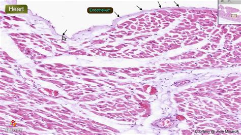 Histology of the Heart wall - Shotgun Histology - YouTube