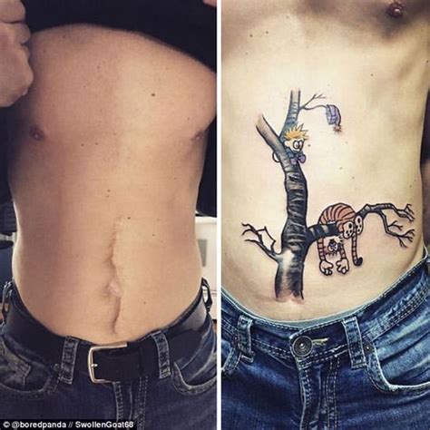 13 People Who Masterfully Transformed Their Scars Into Works Of Art