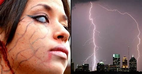 These 10 People Miraculously Survived After Struck By Lightning