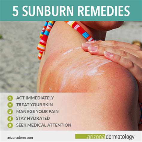 5 Ways to Treat Your Sunburn | Arizona Dermatology