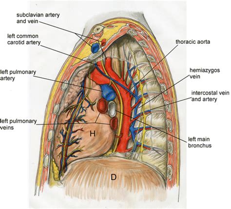 Mediastinum and Heart | Radiology Key