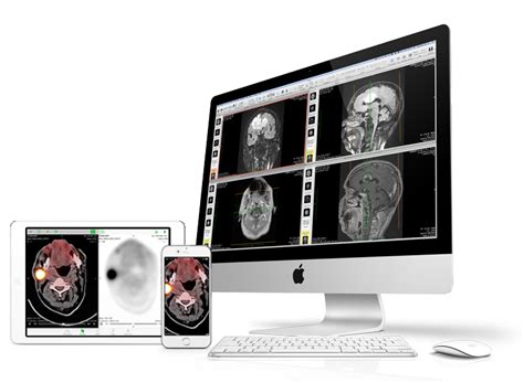 OsiriX DICOM Viewer | The world famous medical imaging viewer