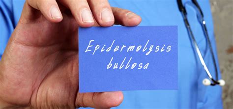 Epidermolysis Bullosa (EB): Causes, Symptoms, Treatments & Prevention