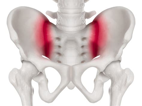 Sacroiliac Joint Dysfunction | Dr Yu Chao Lee