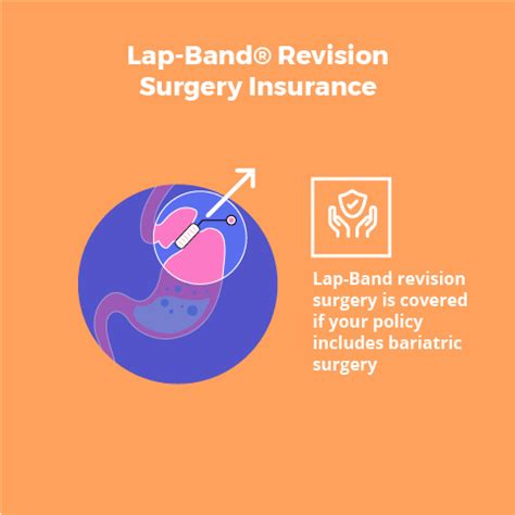 Lap Band Revision Surgery: Your 4 Options - Bariatric Surgery Source