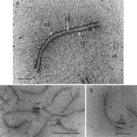 [wild-type strain]: 9 Male synaptonemal complex complement. A total of ...