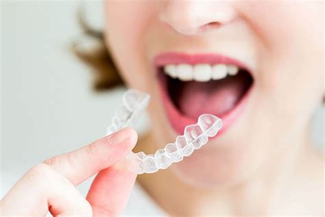 Invisalign for Kids and Adults in Chatsworth CA | Topanga Dental