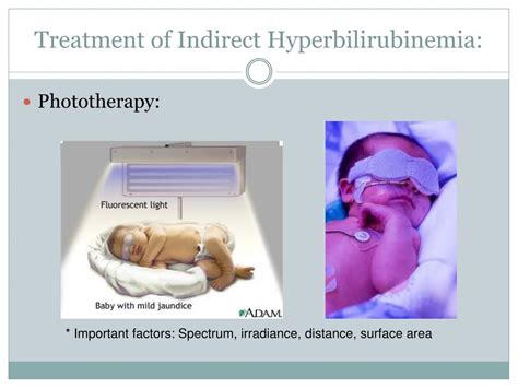 PPT - Neonatal Hyperbilirubinemia PowerPoint Presentation, free download - ID:4448554