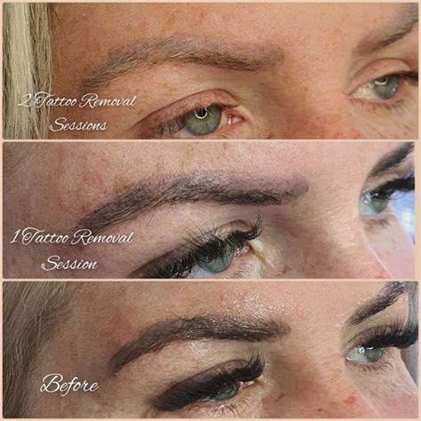 Pink and blue eyebrows after microblading eyebrow tattoo - Elite Look